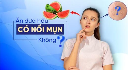 Ăn Dưa Hấu Có Nổi Mụn Không?