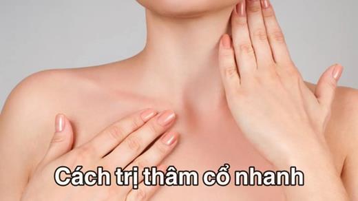 Cách trị thâm cổ nhanh, hiệu quả