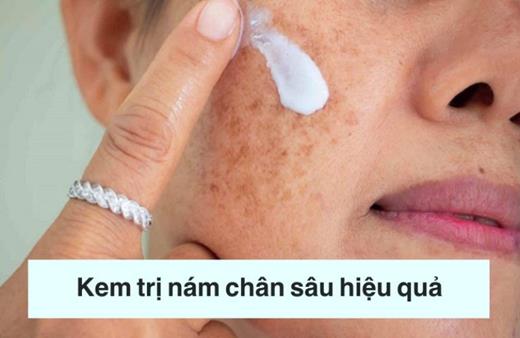 Kem trị nám chân sâu hiệu quả nhất hiện nay