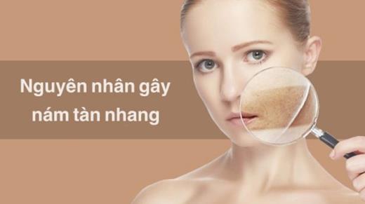 Nguyên nhân gây nám tàn nhang ở nữ giới và nam giới