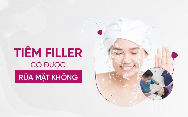 Tiêm filler có được rửa mặt không?